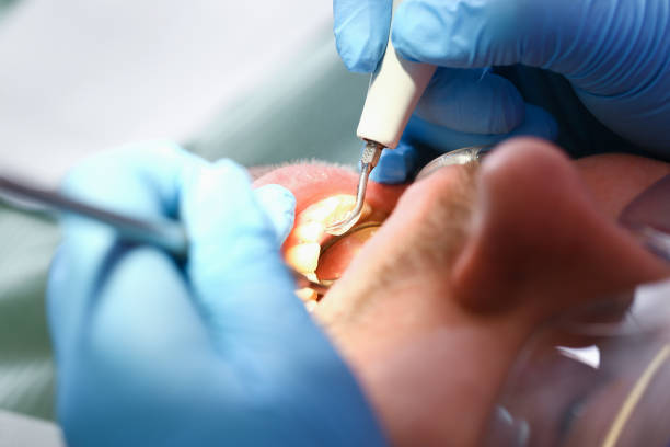 Best Mobile Emergency Dentist in Bernardsville, NJ