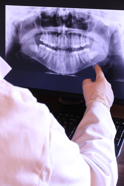Best Emergency Root Canal Treatment in Bernardsville, NJ