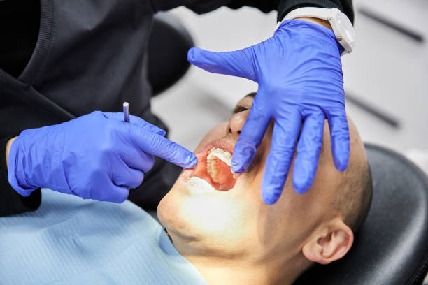 Best Emergency Dental Care for Abscessed Tooth in Bernardsville, NJ